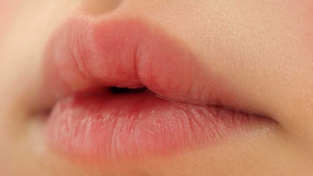 Ce que vos lèvres disent de votre santé
