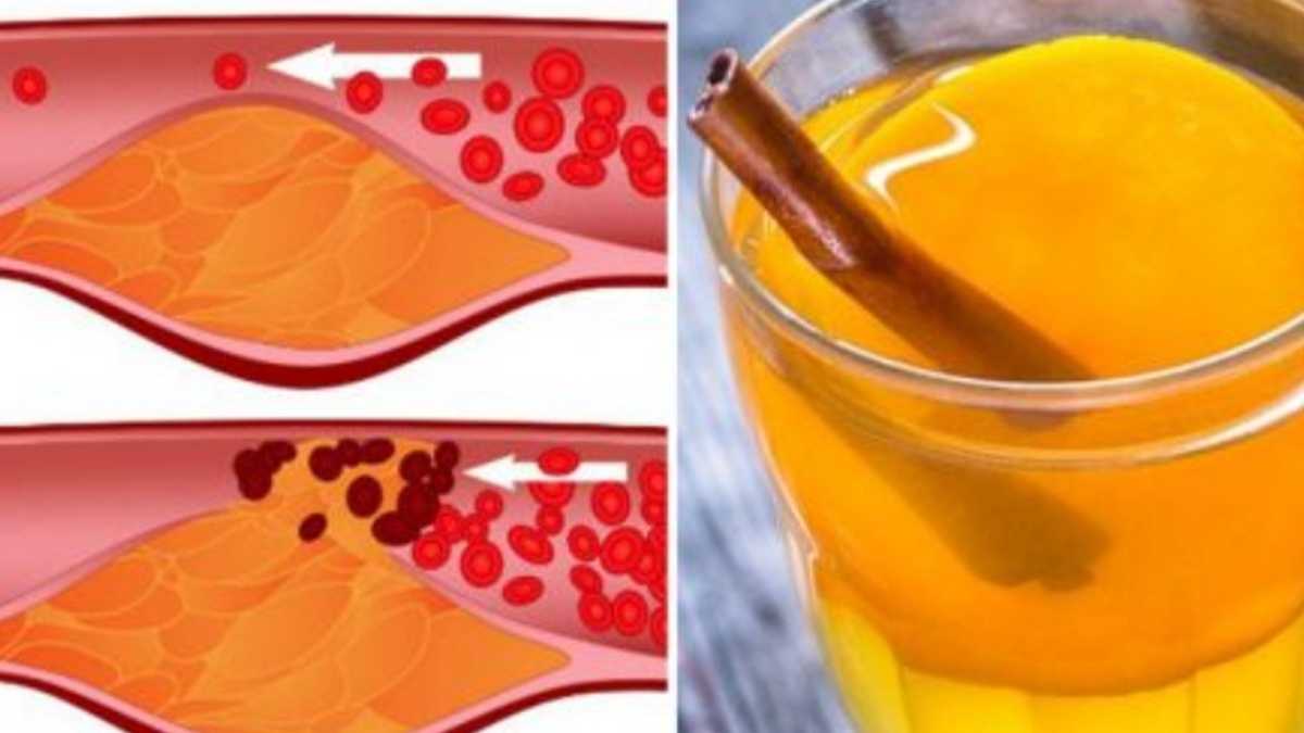 Cannelle et citron pris de cette manière pour réduire le taux de cholestérol et de sucre dans le sang