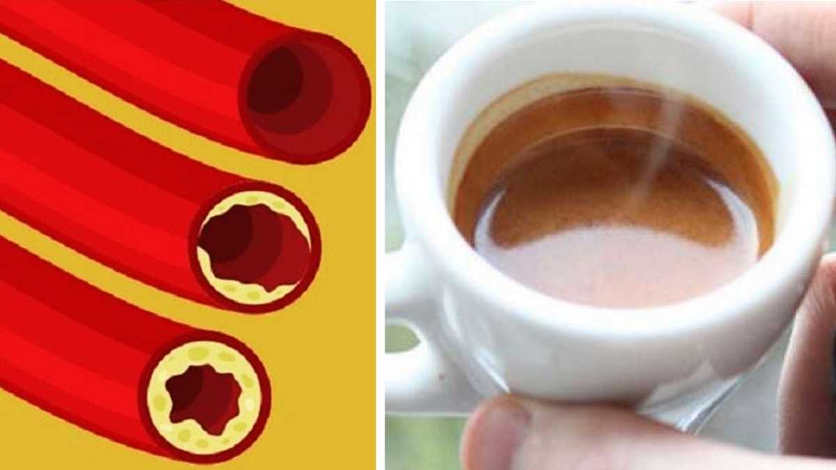 Cholestérol - c'est ce qui se passe si vous buvez 3-4 tasses de café par jour