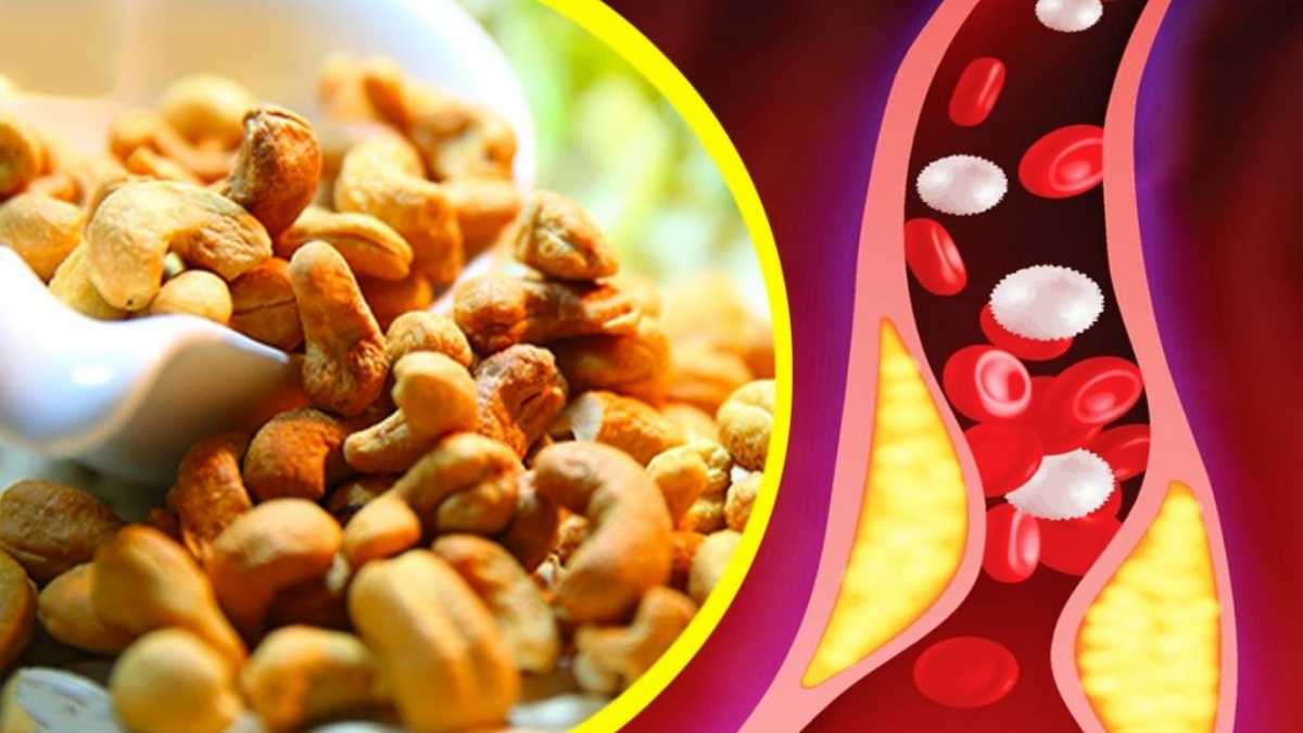 Voici ce qui arrive à votre cholestérol et à votre glycémie si vous mangez 15 noix de cajou par jour