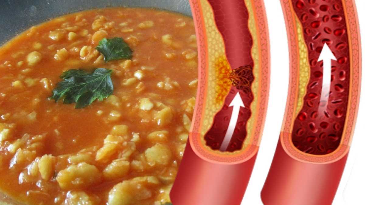 La légumineuse protéinée qui réduit le cholestérol et coupe la faim (1 portion par semaine)
