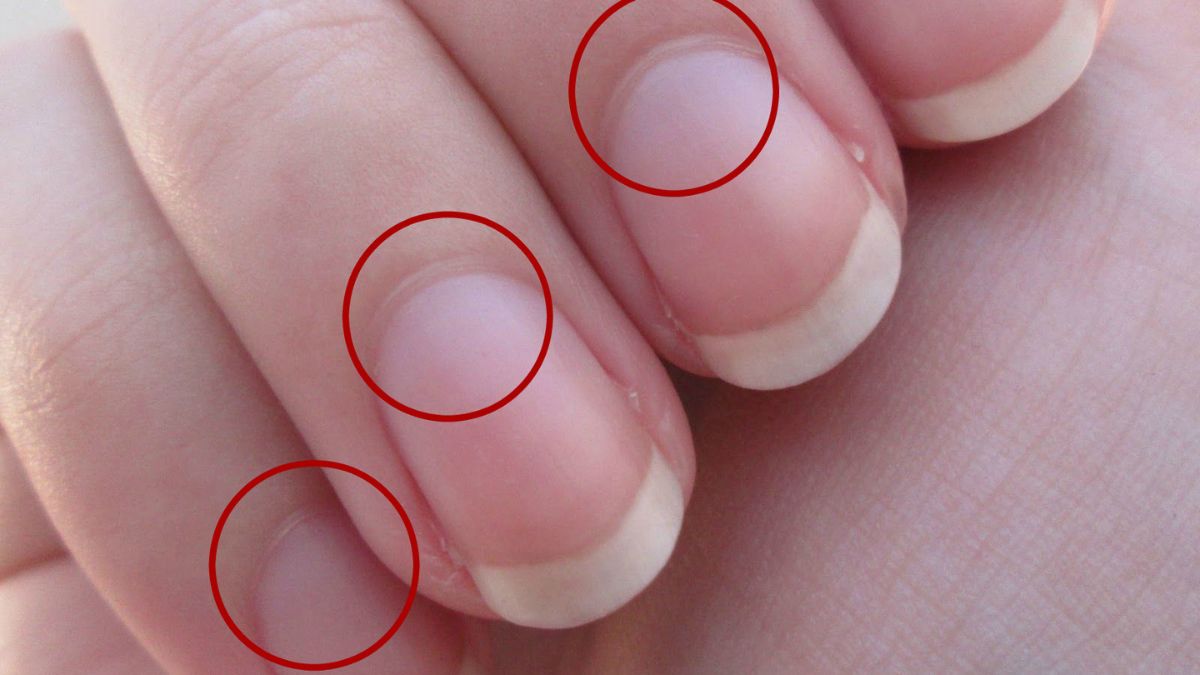 Que signifie l’absence de lunes sur les ongles pour votre santé ?